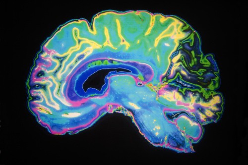 Активность участков головного мозга